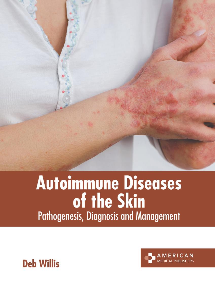 Autoimmune Diseases of the Skin by Deb Willis - McNally Robinson ...