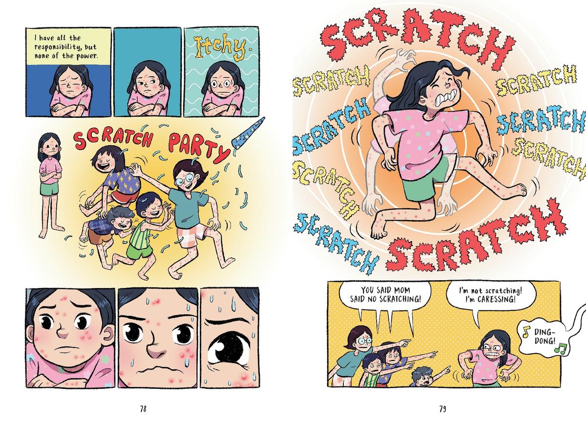 Chickenpox by Remy Lai | Old Town Books