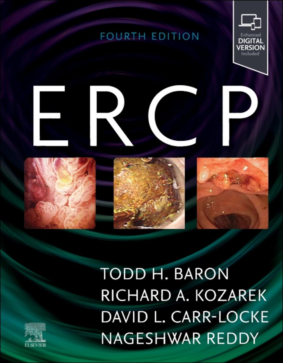 Ercp by Todd H Baron, David L Carr-Locke, Richard A Kozarek | Moon